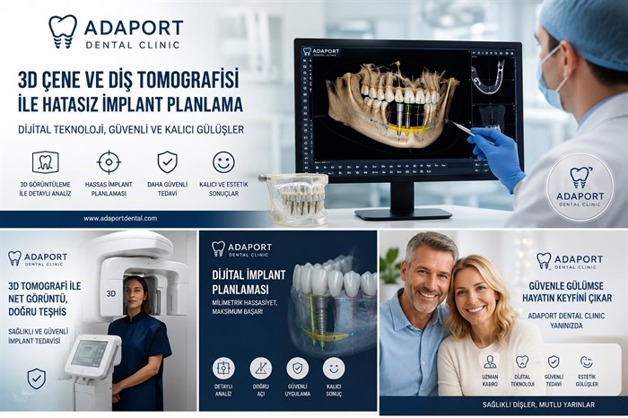 3D Çene ve Diş Tomografisi ile İmplant Planlama