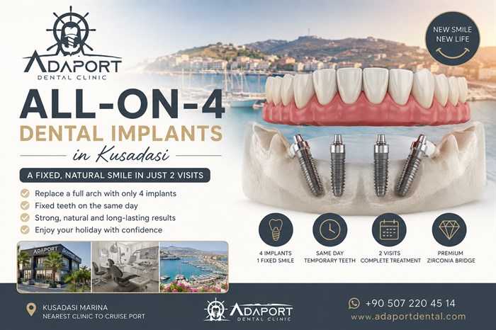 All-on-4 Dental Implants in Kusadasi: The Complete 2026 Guide