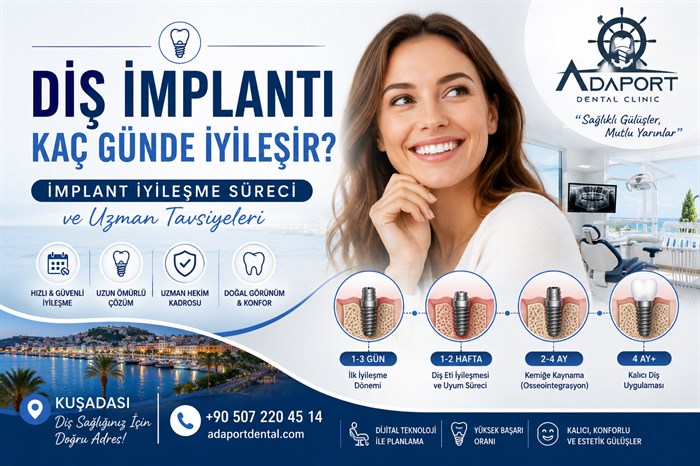 Diş İmplantı Kaç Günde İyileşir?