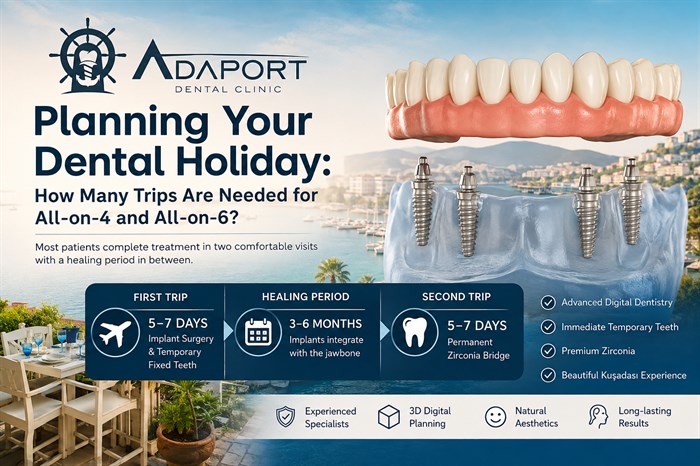 How Many Trips Are Needed for All-on-4 or 6 & How Long Should You Stay in Kuşadası for All-on-x?