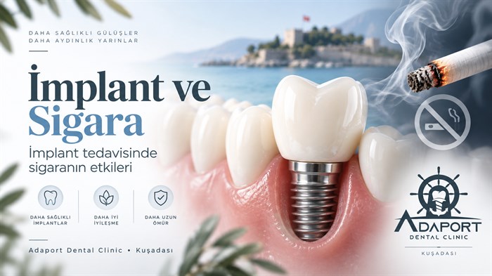 İmplant Sonrası Sigara Ne Zaman İçilir?