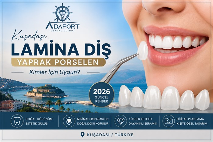 Kuşadası Lamina Diş 2026 | Yaprak Porselen Kimlere Uygun?