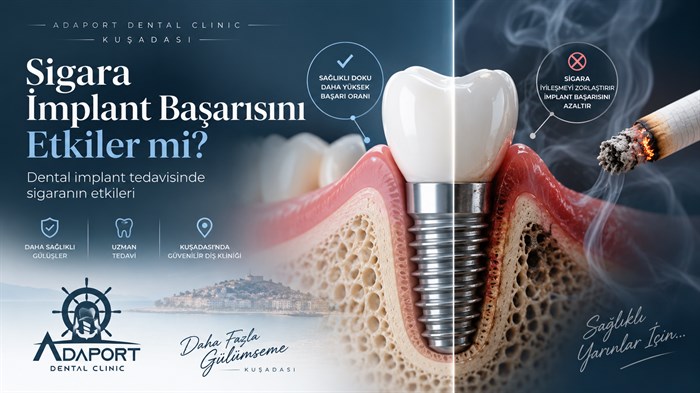 Sigara İmplant Başarısını Etkiler mi?